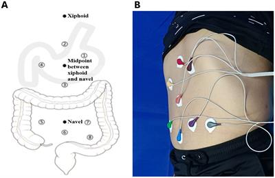 Risk assessment model for sleep disturbance based on gastrointestinal myoelectrical activity in middle-aged and elderly people